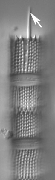 A Granulata Separationspines