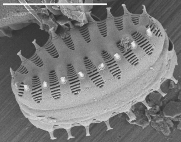 Staurosirella Pinnata Gsn92019  Cook 2001 Scale 5 Microns 7 1039