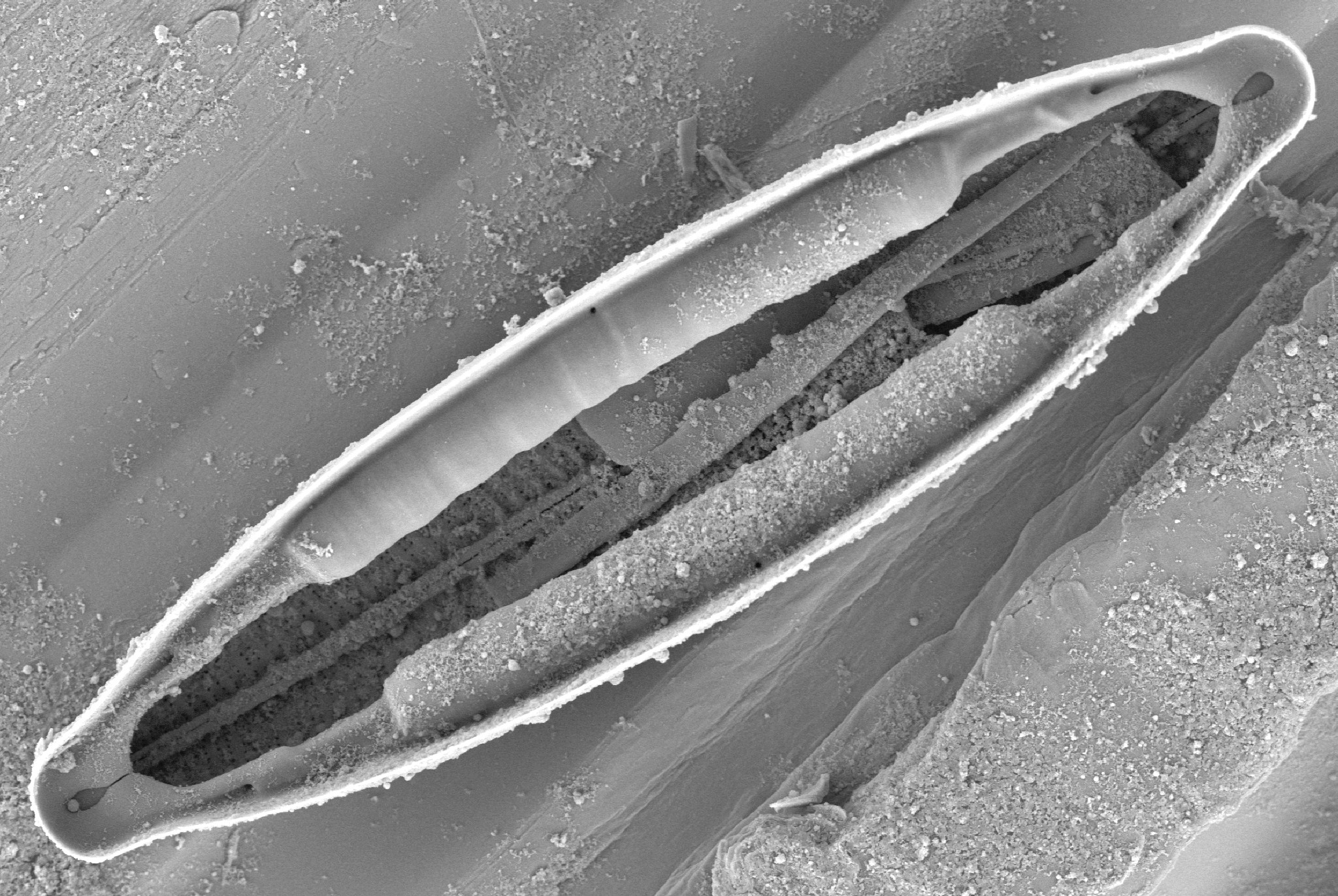 Mastogloia Lacustris Closed Partectal Ring