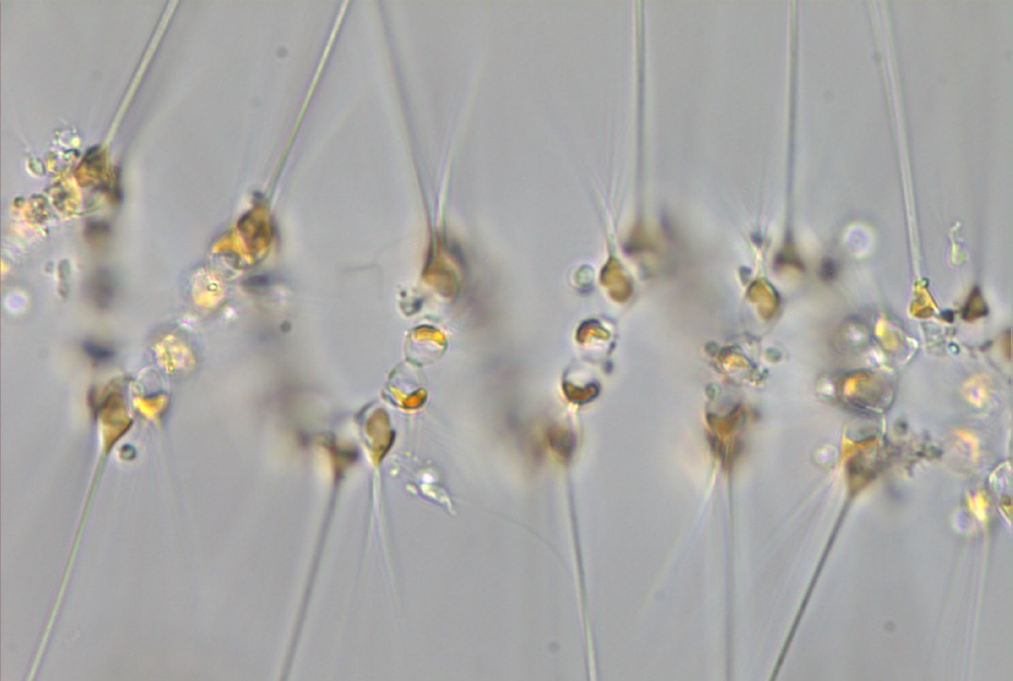 Asterionellopsis T Frankovich