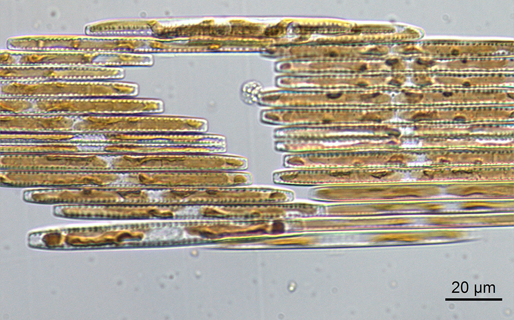 Bacillaria live18945