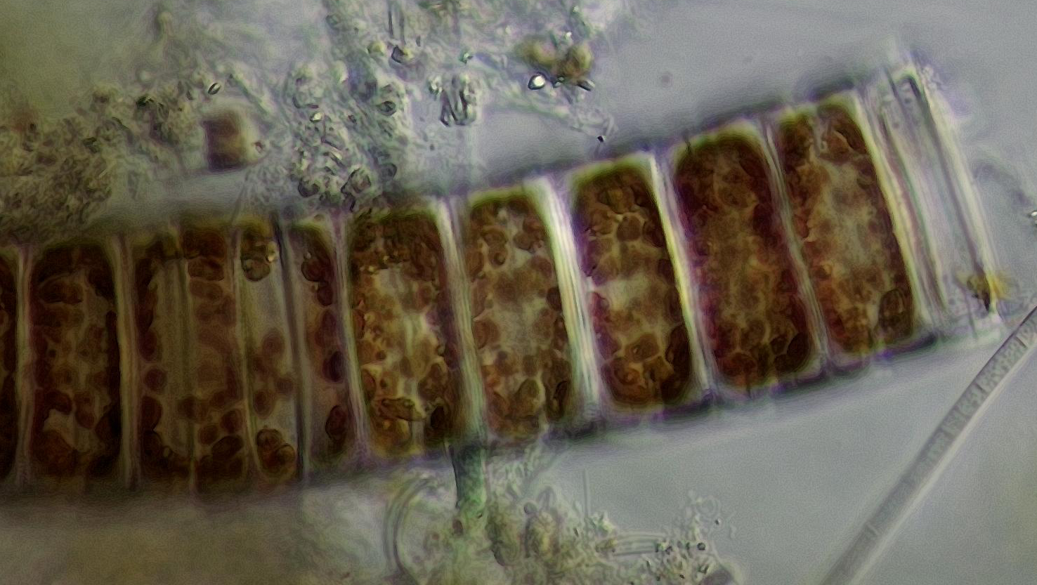 Ellerbeckia live Robin Matthews