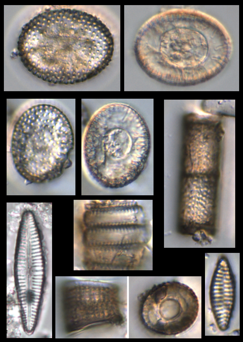 Fig 6 Diatoms in ash layers
