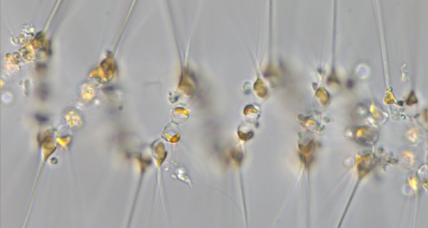 Asterionellopsis T Frankovich