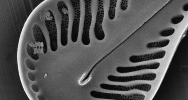 Pinnularia formica SEM ME 10011unfiltered 041918 Mix 010