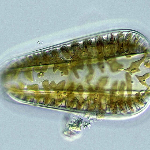 Surirella Robin Matthews