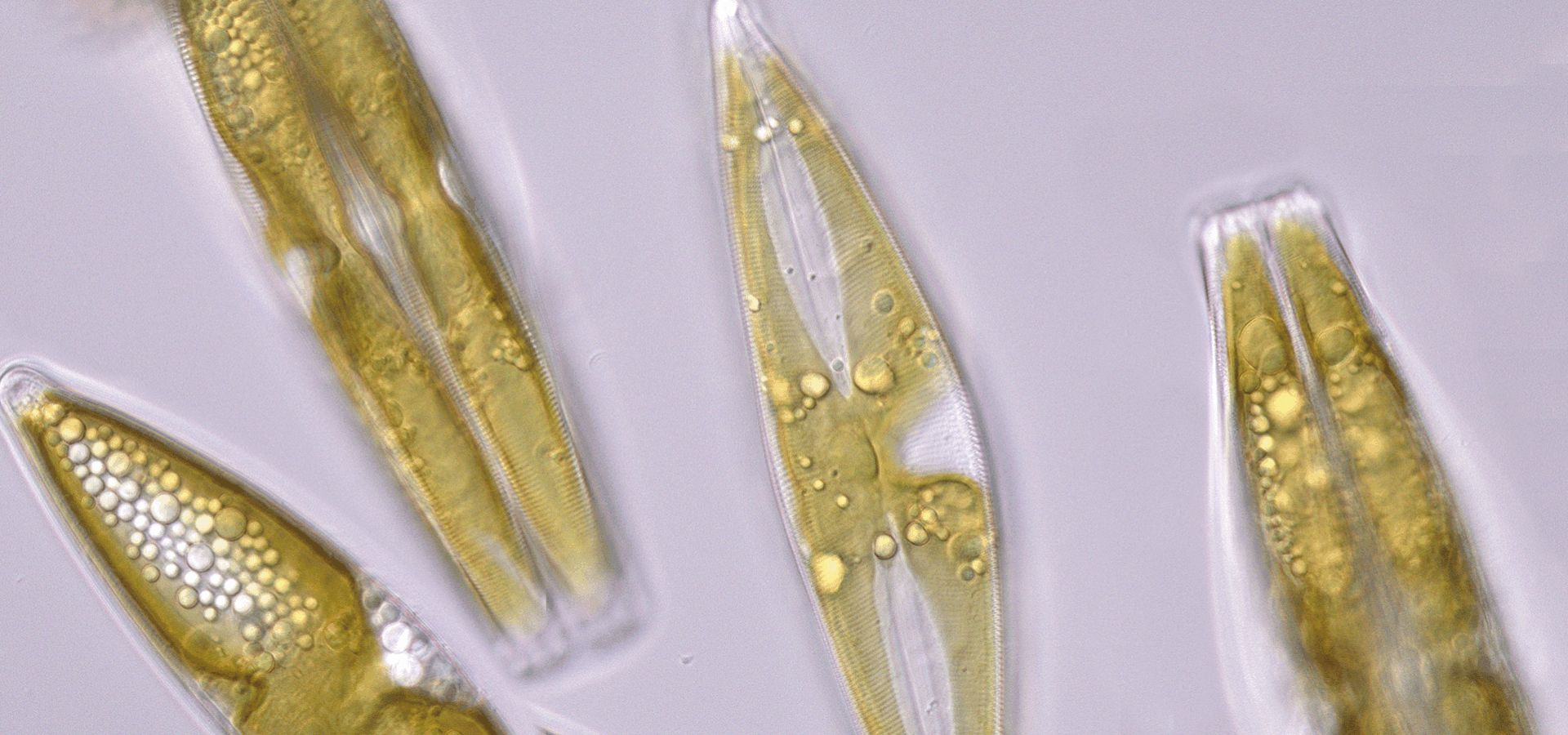 Forest Lake epipelon 06