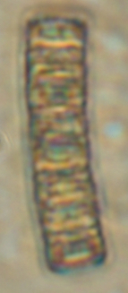 Aulacoseira scalaris Live