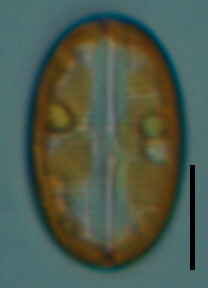 Live Image 1 SRS2 UTRPUR mat