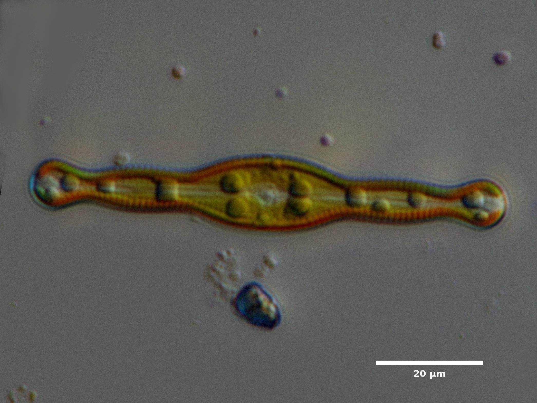 Pinnularia live Matthews