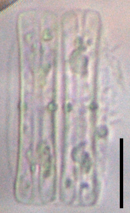 Tursiocola alata LM6