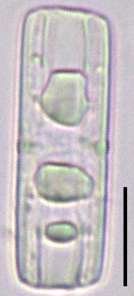 Tursiocola bondei LM6