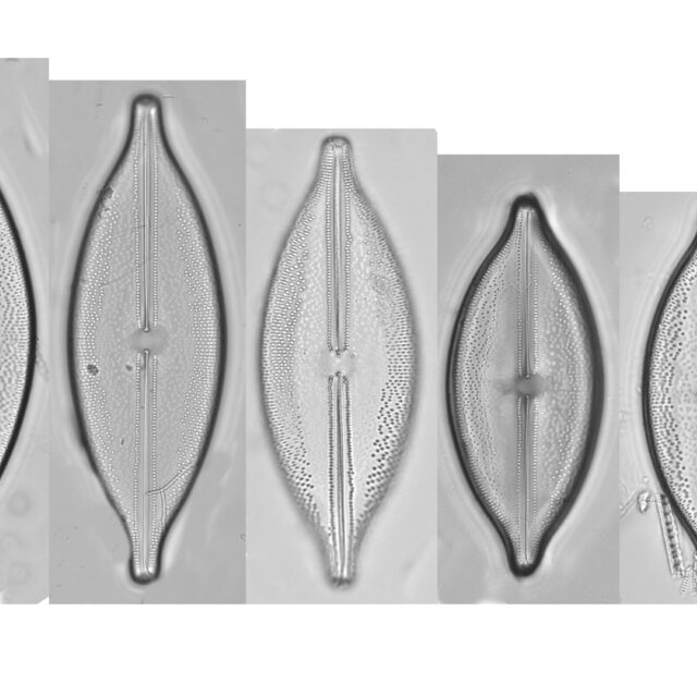 Anomoeoneis Sphaerophora Fo Sculpta Size Series