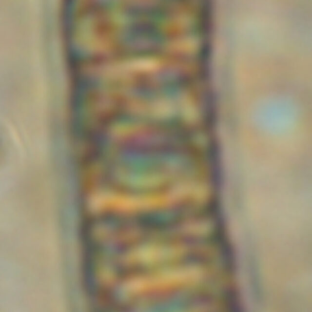 Aulacoseira scalaris Live