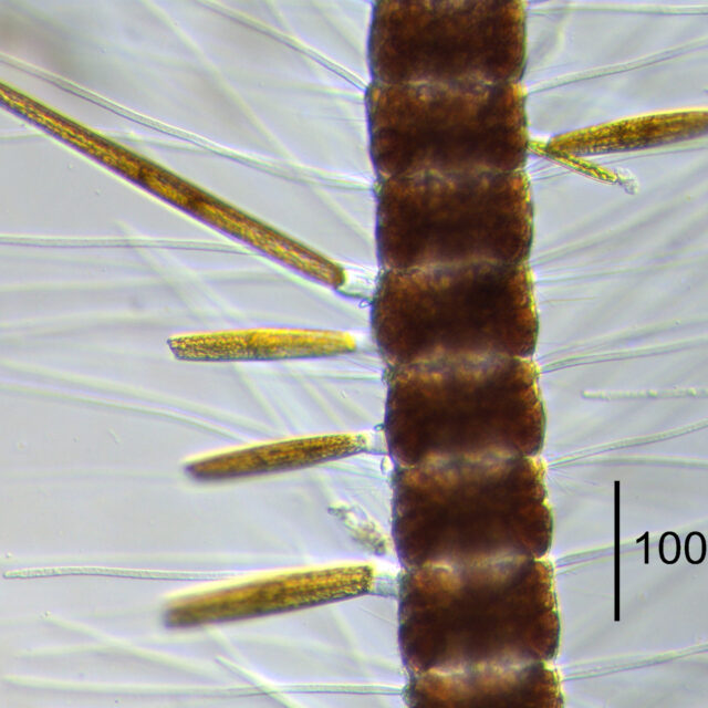 Grunowago bacillaris and Ardissoneopsis fulgicans 20278 live