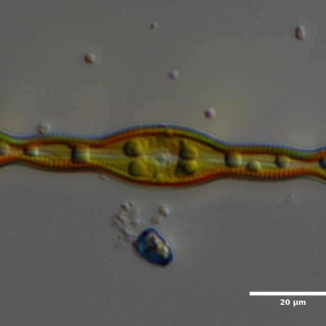 Pinnularia live Matthews