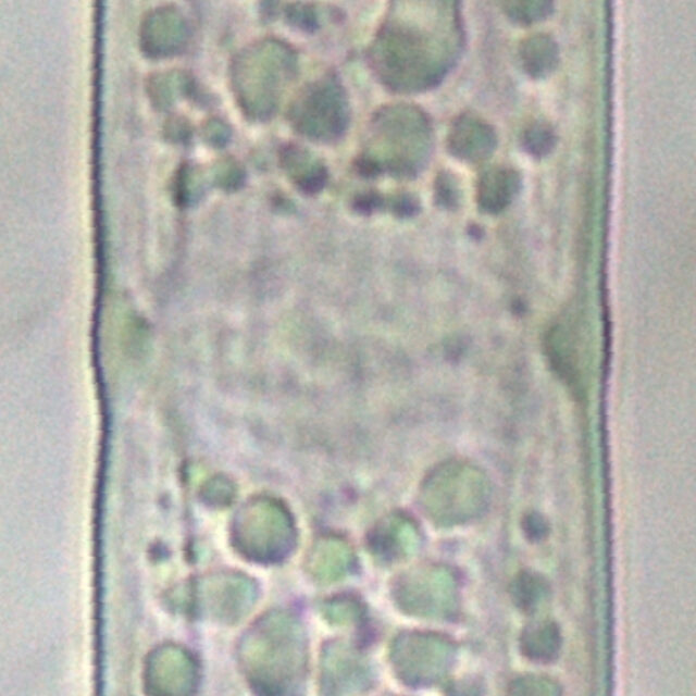 Tursiocola varicopulifera LM7