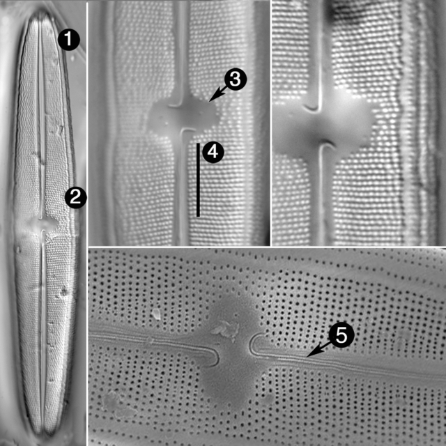 Neidium rugosum guide33