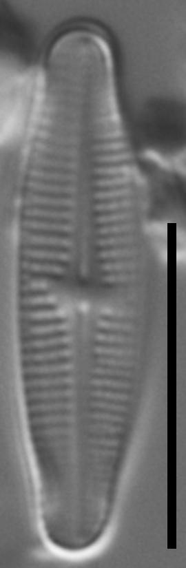 Achnanthidium thienimannii LM1