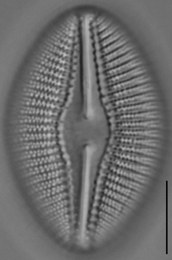 Diploneis dilatata LM1