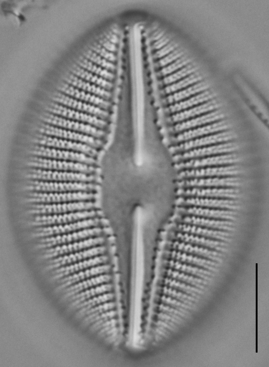 Diploneis dilatata LM2
