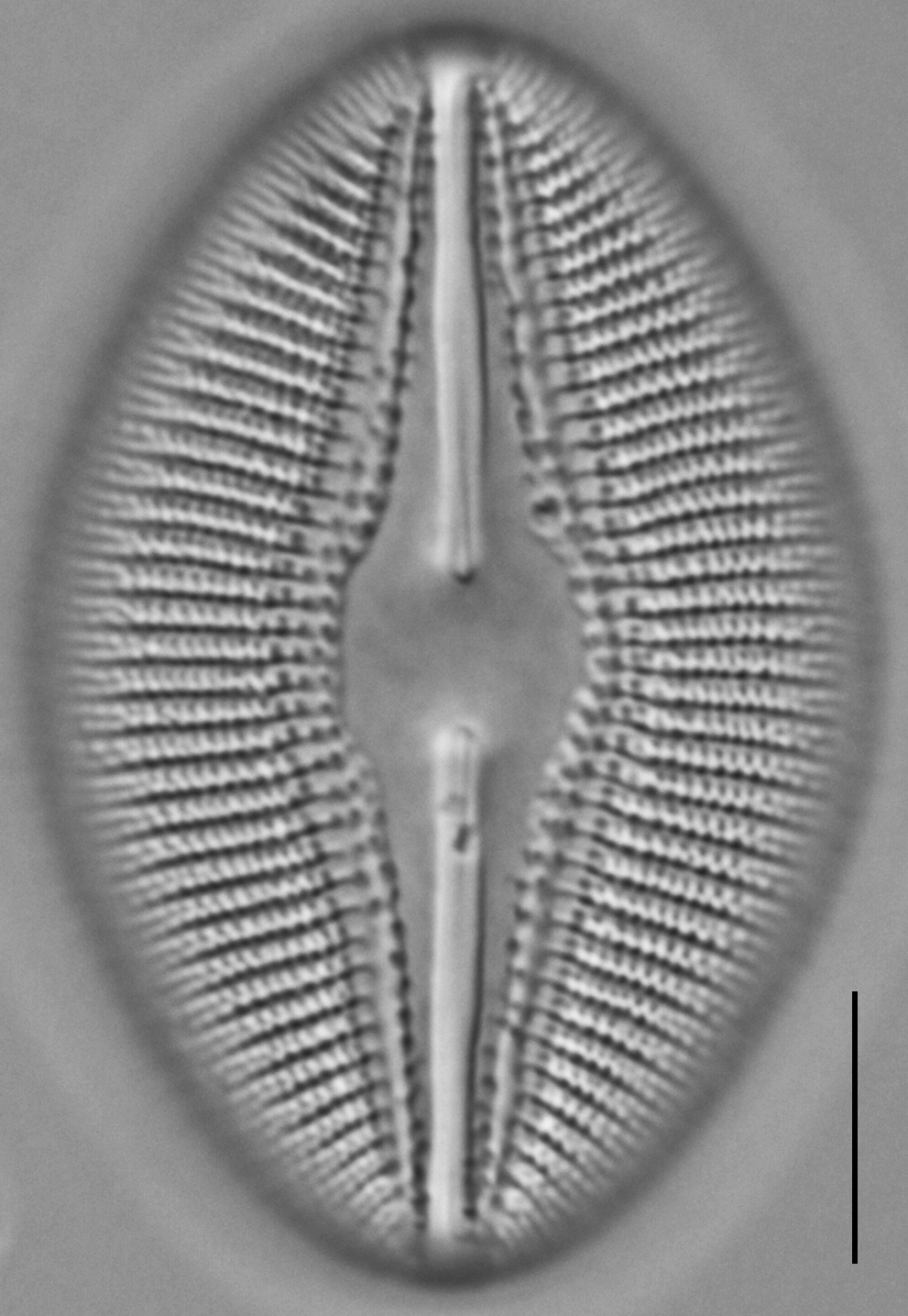 Diploneis dilatata LM3