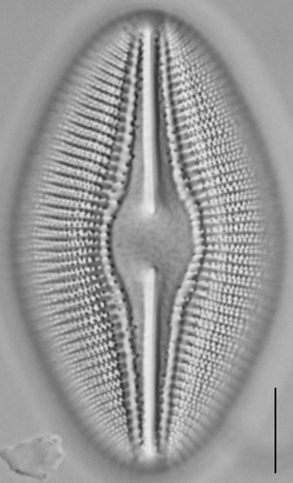 Diploneis dilatata LM5