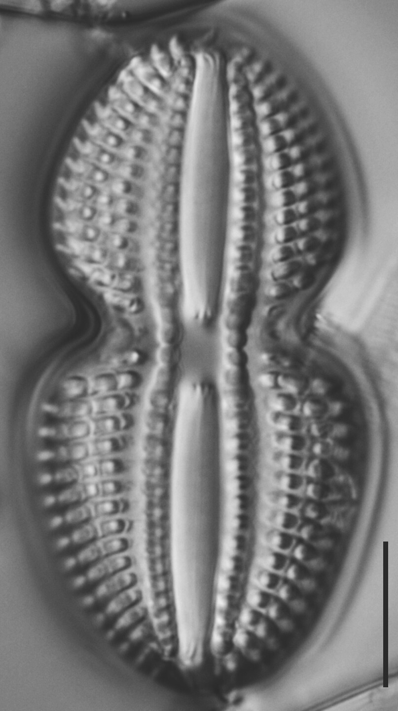 Diploneis bombus LM1