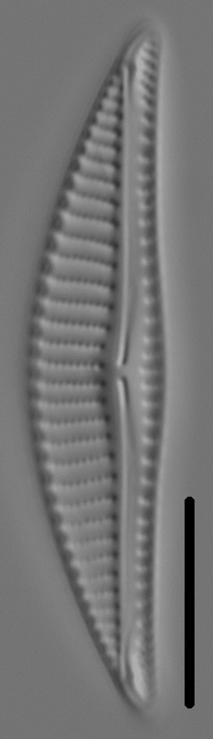 Encyonema silesiacum var elegans LM6