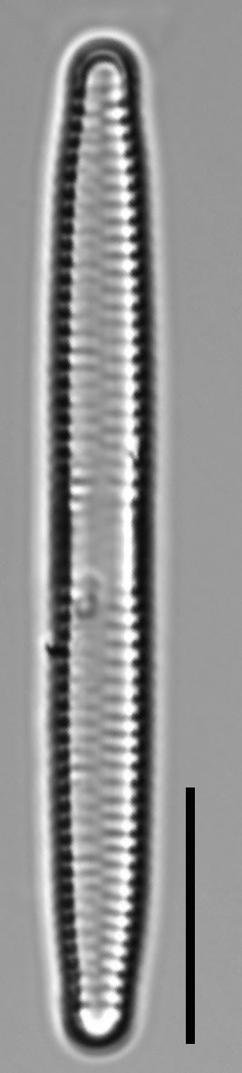 Fragilaria capucina LM1