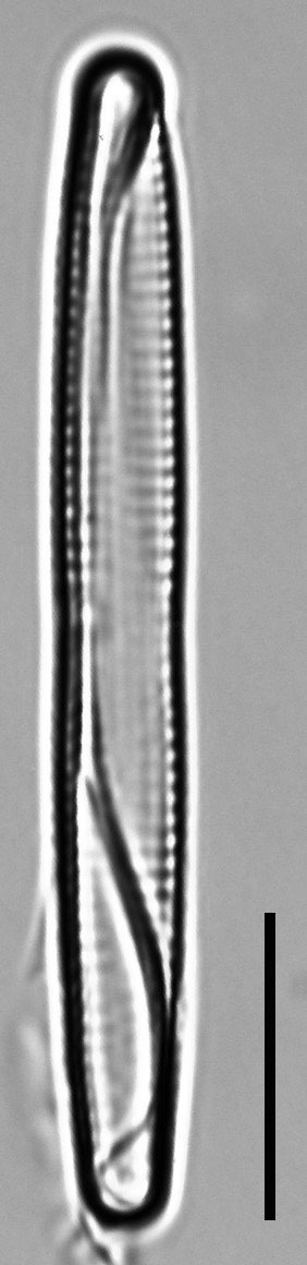 Fragilaria capucina LM2