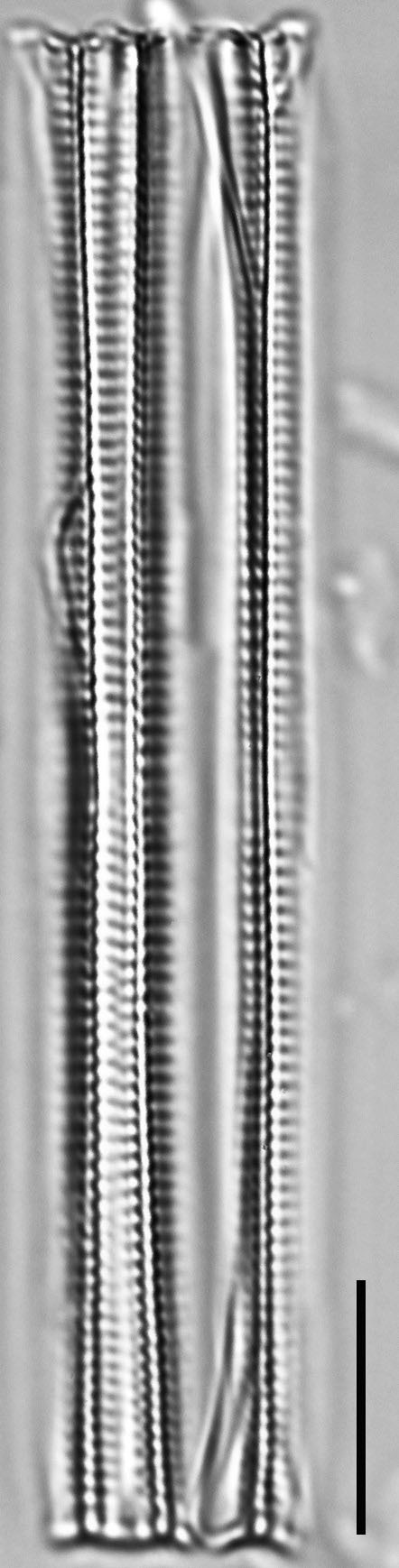 Fragilaria capucina LM5