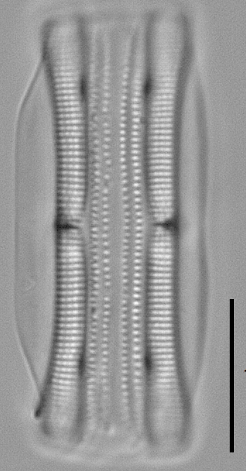 Tursiocola alata LM1