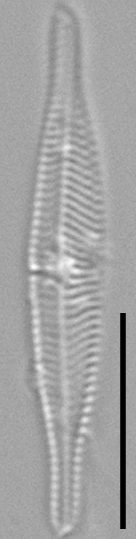 Tursiocola costata LM1 r