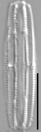 Tursiocola costata LM4 r