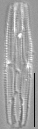 Tursiocola costata LM5 r