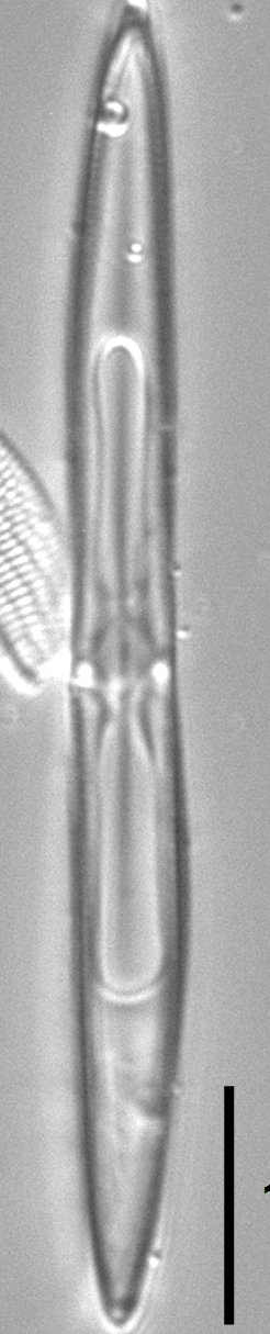 Tursiocola varicopulifera LM2