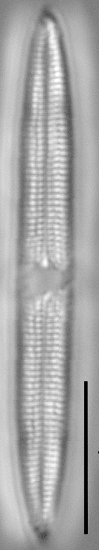 Tursiocola varicopulifera LM3