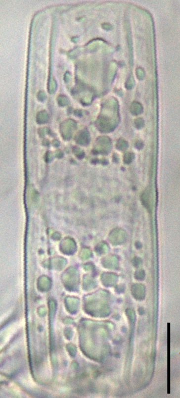 Tursiocola varicopulifera LM7