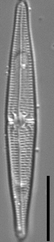 Tursiocola ziemanii LM1