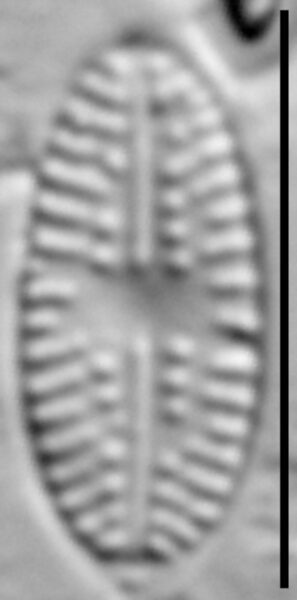 Eolimna sp.1 SESQA LM5