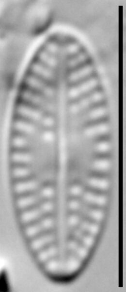 Eolimna sp.1 SESQA LM7