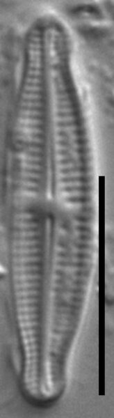 Achnanthidium thienimannii LM2