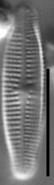 Achnanthidium thienimannii LM3