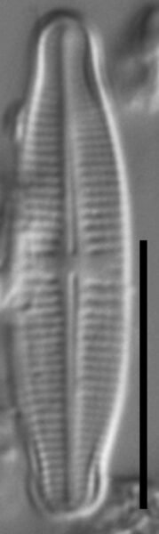 Achnanthidium thienimannii LM6