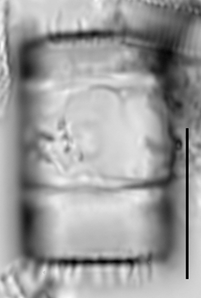 Aulacoseira pseudoamericana LM1