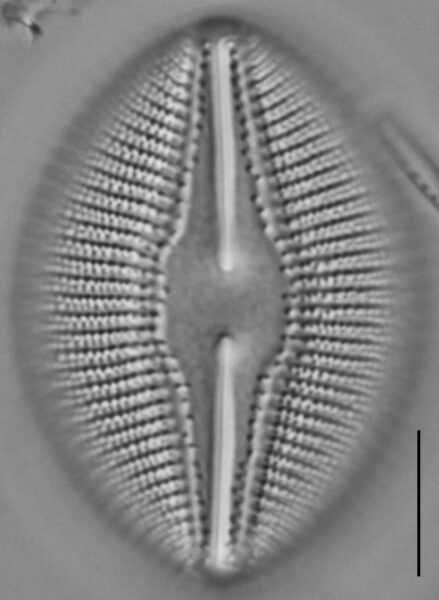 Diploneis dilatata LM2