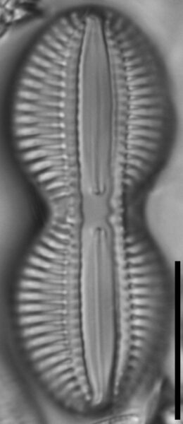 Diploneis interrupta LM1