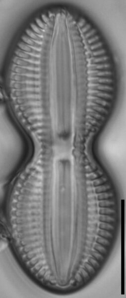 Diploneis interrupta LM3