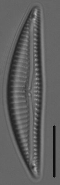Encyonema silesiacum var elegans LM4